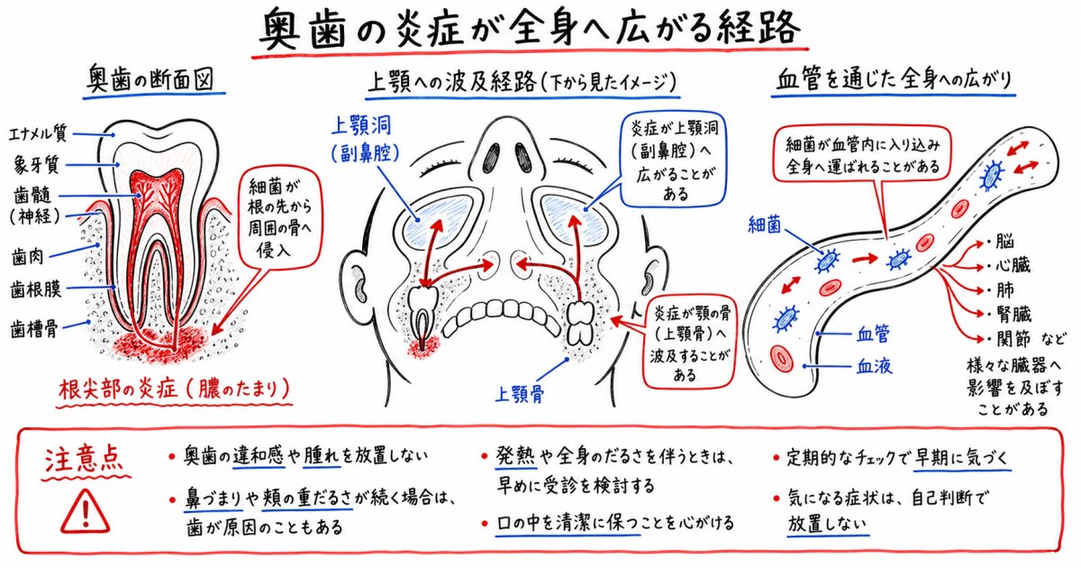痛まないむし歯を放置するリスクと全身への波及
